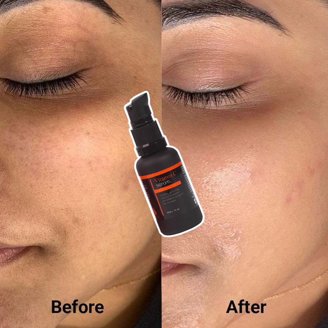 Vitamin C Serum